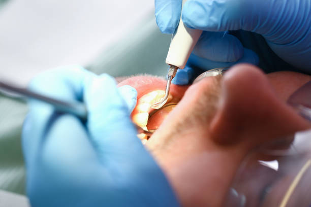 Best Knocked-Out Tooth Emergency  in Bangor, PA