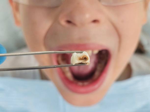 Best Broken Tooth Emergency  in Bangor, PA